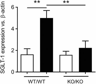 Gut Mechanisms Linking Intestinal Sweet Sensing to Glycemic Control